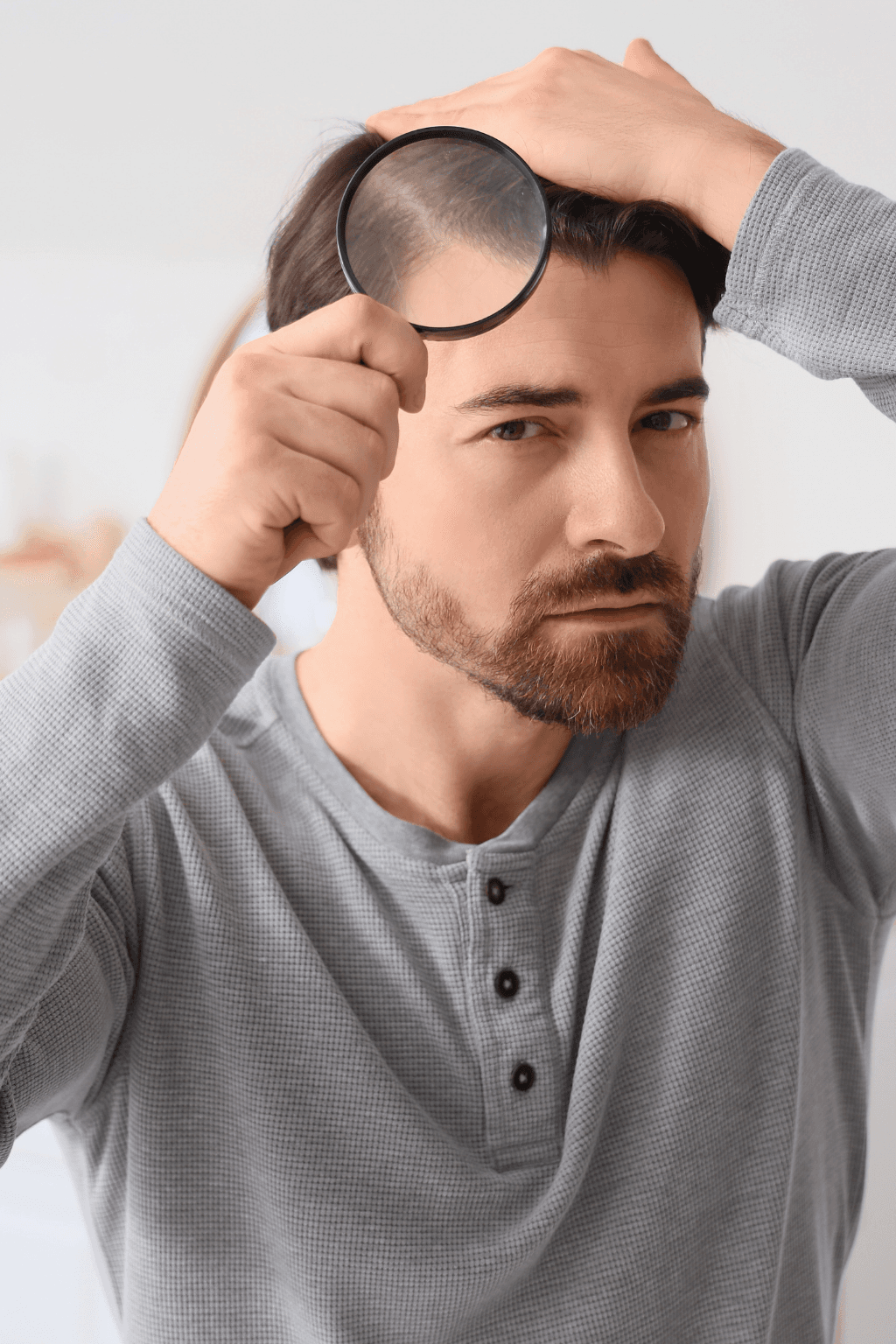 Alopecia androgénica: causas, síntomas y opciones de tratamiento